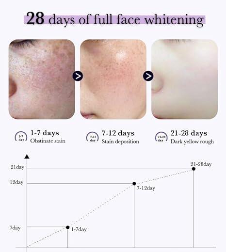 Esencia Iluminadora Blanqueadora Antipecas (30ml) - Mimaste